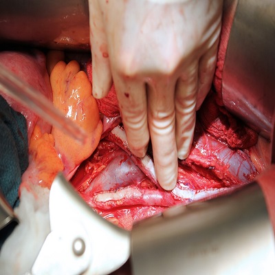 Varicose veins & venous disorders 